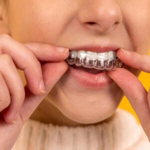 Invisalign cagdisdental (1)(2)(1)