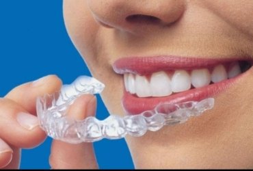 Invisalign cagdisdental (2)