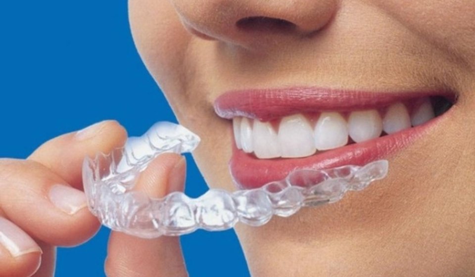 Invisalign cagdisdental (2)