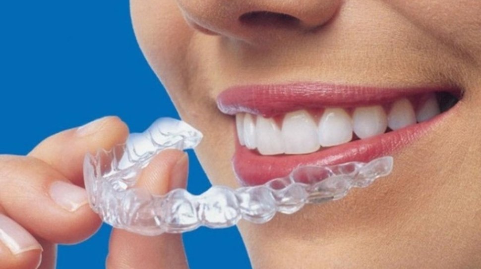 Invisalign cagdisdental (2)